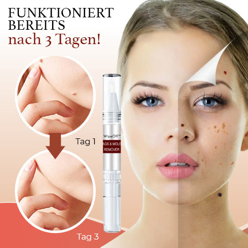 WipeOff Tags & Mole Remover - Effectieve oplossing voor een heldere, gladde huid