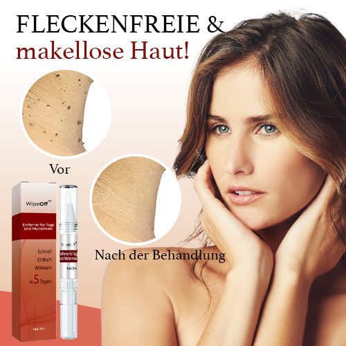 WipeOff Tags & Mole Remover - Effectieve oplossing voor een heldere, gladde huid