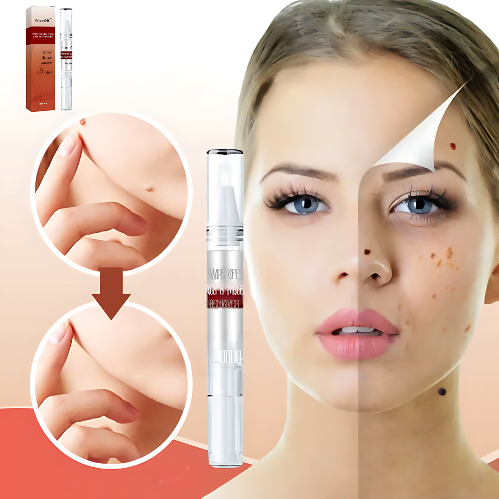 WipeOff Tags & Mole Remover - Effectieve oplossing voor een heldere, gladde huid